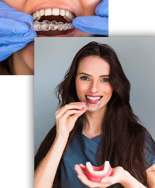 Alignement Invisalign